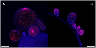 The muscle and neural architecture of Taenia crassiceps cysticerci revisited; implications on head-tail polarization of the larvae